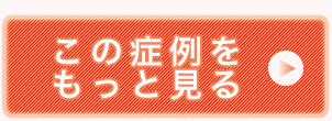 治療経過はこちら＞＞過蓋咬合