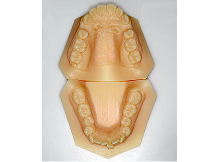 CEREC Ortho を用いた 最先端のインビザライン治療